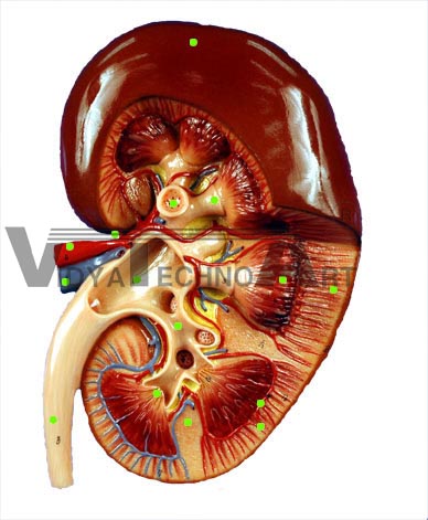 Kidney Model I